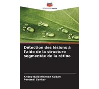 Anoop Balakrishnan Détection des lésions à l'aide de la structure s (Tascabile)