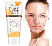 Anti Macchie Crema, Schiarente Viso, Anti-lentiggini, Utilizzato per Tono Della Pelle Irregolare, Rimozione Macchie Scure, Anti-melanina, Sbiancante -50ml