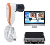 ANXYYDS Analizzatore Telecamera per Polizia/iridologia a infrarossi con Software PRO (con 30 x Iris)