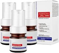 Aobenz Anti Spot Serum,Aobenz Whitening And Freckle Removing Essence,Vitamin C Blemish Serum For Face,Magic Whitening Spot Cream,Dark Spot Correcting Serum,Dark Spot Removal (3 Pcs)