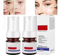Aobenz Whitening and Freckle Removing Essence,Anti-Spot Serum,Dark Spot Correcting Serum,Spot Remover for Face,Removing Freckles (2 Pcs)