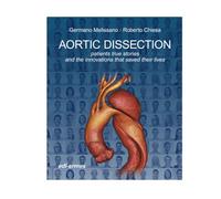 Aortic dissection. Patients true stories and the innovations that saved their lives
