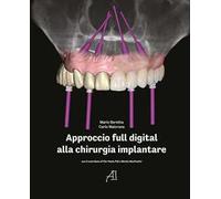 Approccio full digital alla chirurgia implantare
