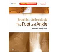 Arthritis and Arthroplasty: the Foot and Ankle: Expert Consult - Online, Print a