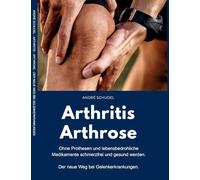 Arthritis - Arthrose. Ohne Prothesen und lebensbedrohliche Medikamente schmerzfrei und gesund werden. Der neue Weg bei Gelenkerkrankungen: Was hilft konkret bei Arthritis und/oder Arthrose?