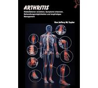 Arthritis: Risikofaktoren verstehen, Symptome erkennen, Behandlungsmöglichkeiten und langfristiges Management