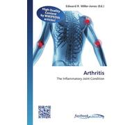 Arthritis: The Inflammatory Joint Condition