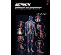 Arthritis: Understanding Risk Factors, Symptom Recognition, Treatment Options, and Long-Term Management