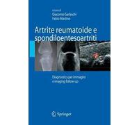 Artrite reumatoide e spondiloentesoartriti
