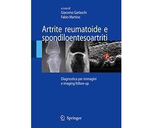 Artrite reumatoide e spondiloentesoartriti: Diagnostica per immagini ed imaging follow-up