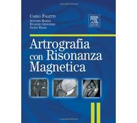 Artrografia con risonanza magnetica