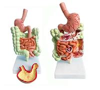 asdchZen Modello di Anatomia Gastrointestinale Umana, Modello Dell'Apparato Digerente Umano, Modello di Malattia del Colon, Struttura degli Organi Interni per L'Insegnamento nelle Esposizioni Mediche