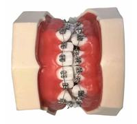 asdchZen Modello di Denti Dentali Typodont - Modello Gengivale Rimovibile per Esercitarsi - per Studio Modello Didattico Standard per Adulti, Carne, 8 Cm, Carne, 8 Cm