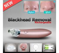 ASPIRATORE RIMUOVERE PUNTI NERI AD ULTRASUONI PULIZIA VISO FACCIALE PORTATILE