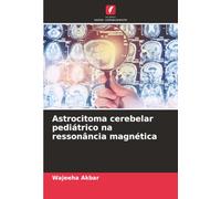 Astrocitoma cerebelar pediátrico na ressonância magnética