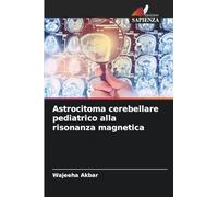 Astrocitoma cerebellare pediatrico alla risonanza magnetica