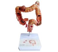 Asyduey Modello Didattico, Modello Anatomico 'Intestino Crasso Umano Modello Lesione Viscerale Modello di Apprendimento del Digestivo Umano Facile Installazione Facile da Usare
