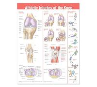 Athletic Injuries of the Knee Anatomical Chart