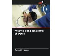 Atlante della sindrome di Down