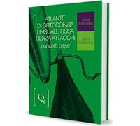 Atlante di Ortodonzia Linguale Fissa Senza Attacchi. Concetti Base