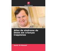 Atlas da síndrome de Down em crianças iraquianas