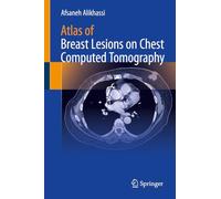 Atlas of Breast Lesions on Chest Computed Tomography