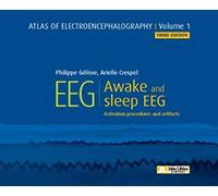 Atlas of Electroencephalography -- Volume 1: Awake and sleep EEG