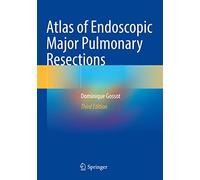 Atlas of Endoscopic Major Pulmonary Resections