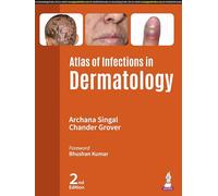 Atlas of Infections in Dermatology