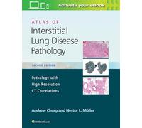 Atlas of Interstitial Lung Disease Pathology: Pathology With High Resolution Ct Correlations