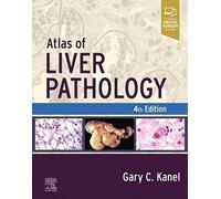 Atlas of Liver Pathology