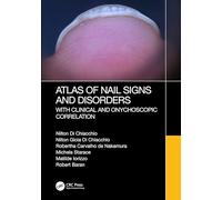 Atlas of Nail Signs and Disorders with Clinical and Onychoscopic Correlation