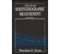 Atlas of Normal Roentgen Variants That May Simulate Disease