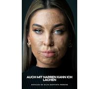 Auch mit Narben kann ich lachen