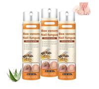 Avanzato spray per la riparazione delle unghie, siero all'essenza per la riparazione delle unghie, nutriente e idratante, penetra in profondità nella pelle, soluzione lieve, riparatrice e rinforzante