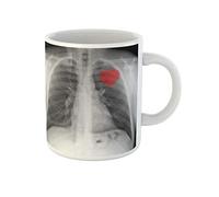 Awowee Tazza da caffè con cuore rosso su X Ray petto ossa rotte 325 ml tazza da tè in ceramica miglior regalo o souvenir per familiari, amici e colleghi