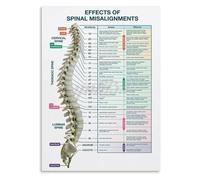 AXCAUAOY Chiropractic Nerve Function Chart, Vertebral Subluxation and Spinal Health Diagram Canvas Wall Art for Clinic Living Room Decor(Framed,08x12inch(20x30cm))