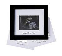 Baby Sonogram - Cornice portafoto a ultrasuoni, idea regalo per genitori in attesa di nascita, festa di genere, decorazione per la cameretta dei bambini