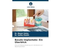 Basale Implantate: Ein Überblick: Eine schrittweise Anleitung zum Verständnis von Basalimplantaten