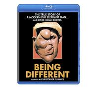 Being Different