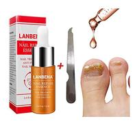 Beito 1PC Nail Riparazioni Soluzione per il rinnovo delle unghie di oli essenziali uccide il fungo protegge dal decolorazione Trattamento dei funghi del chiodo per unghie fragili e screpolate (12ML)
