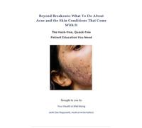 Beyond Breakouts: What To Do About Acne and the Skin Conditions That Come With It: The Hack-free, Quack-free Patient Education You Need