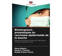 Biomarqueurs pronostiques du carcinome épidermoïde de la bouche: Expression des protéines CD90 et HIF-1 alpha dans le microenvironnement tumoral