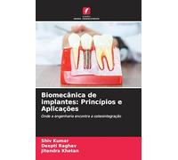 Biomecânica de implantes: Princípios e Aplicações: Onde a engenharia encontra a osteointegração