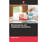 Biomecânica em implantes dentários