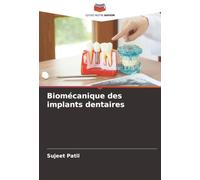 Biomécanique des implants dentaires