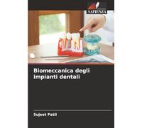 Biomeccanica degli impianti dentali