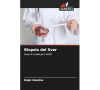 Biopsia del liver: Cosa c'è in ballo per il 2025?
