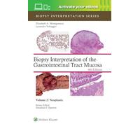 Biopsy Interpretation of the Gastrointestinal Tract Mucosa Volume 2: Neoplastic: Print + eBook with Multimedia (Volume 2) (Biopsy Interpretation Series)