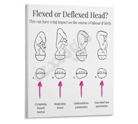 Birth Process Educational Poster Cardinal Movements and Fetal Position Chart for Nursing School Skills Lab(Unframed,16x24inch(40x60cm))